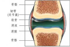 膝盖咯吱咯吱的响，是暗示你有滑膜炎了？